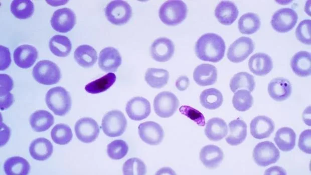 ¿Qué es la Malaria?